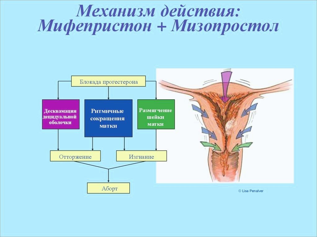 Схема прерывания беременности мифепристон и миролют